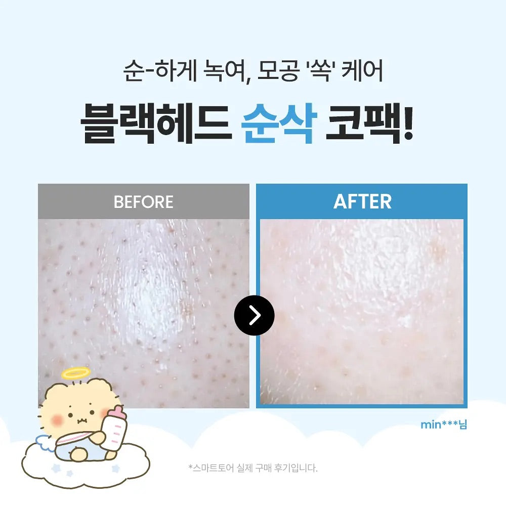 專為黑頭、皮脂及毛孔研發| ilso x 溫和粉刺黑頭深層清潔導出鼻膜 Natural Mild Clear Nose Pack✨