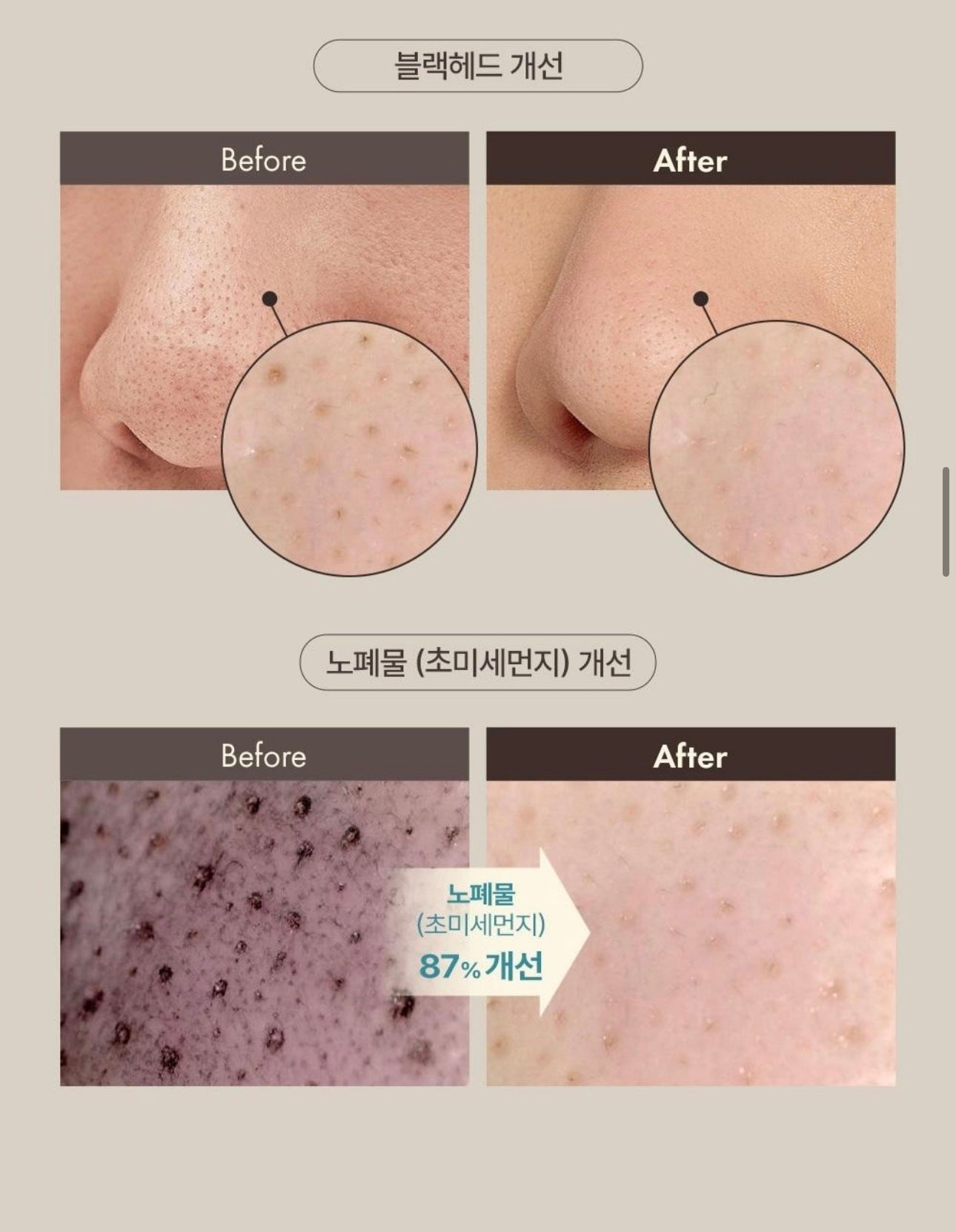 OBgE 黑頭粉刺去角質清潔棒🫧 OBgE Blackhead Scrub Balm✨ 一抹即淨、懶人首選 🚀