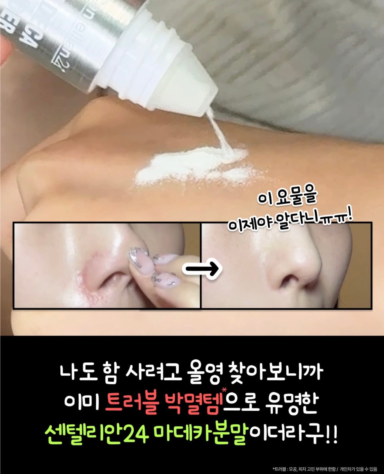 送去痘凝膠精華✨Centellian24 積雪草茶樹舒緩淨痘雙效修護粉