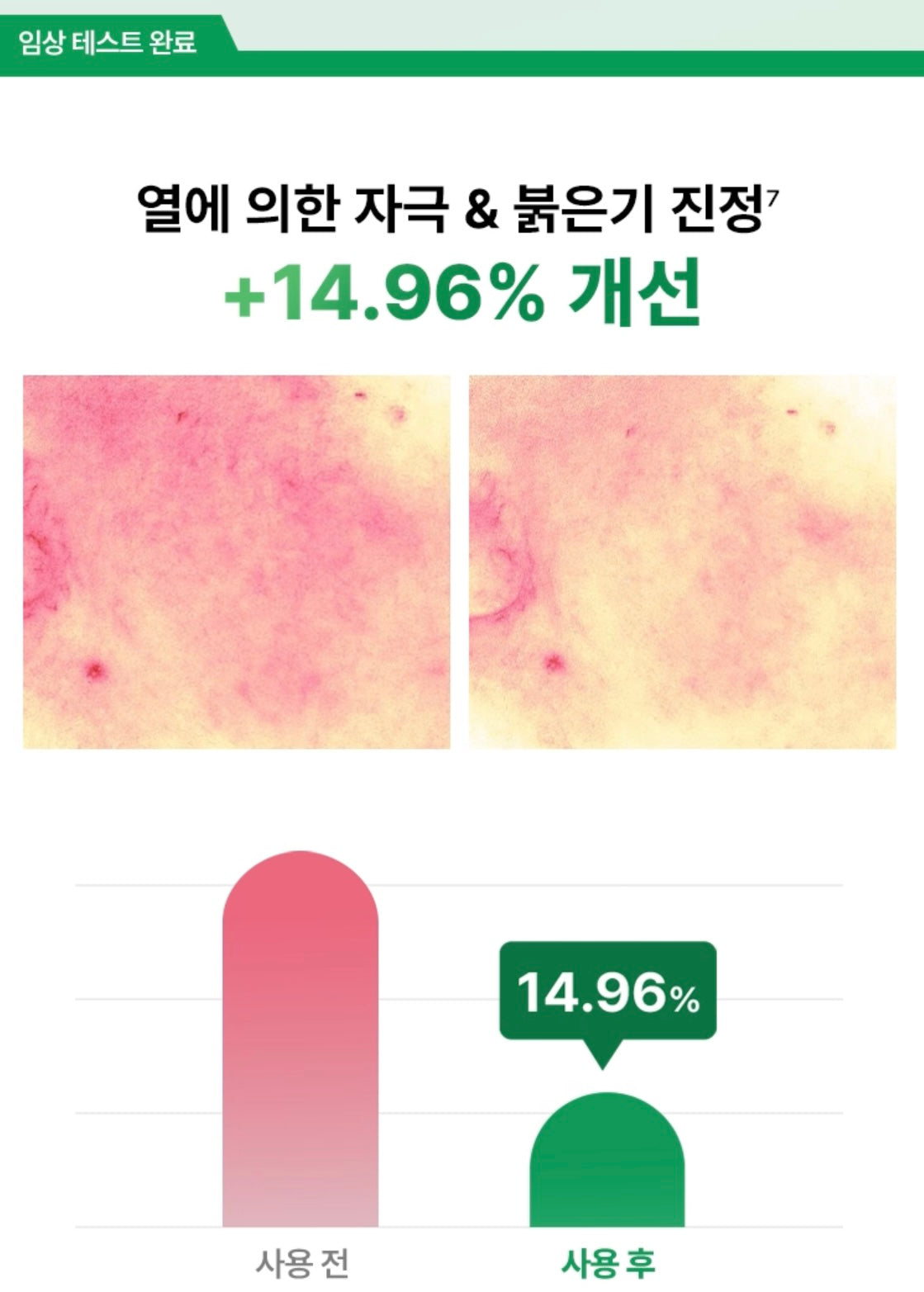 🌿 涼感舒緩！Parnell 積雪草草本高濃縮舒緩精華噴霧🌱 PARNELL CICAMANU SERUM MIST