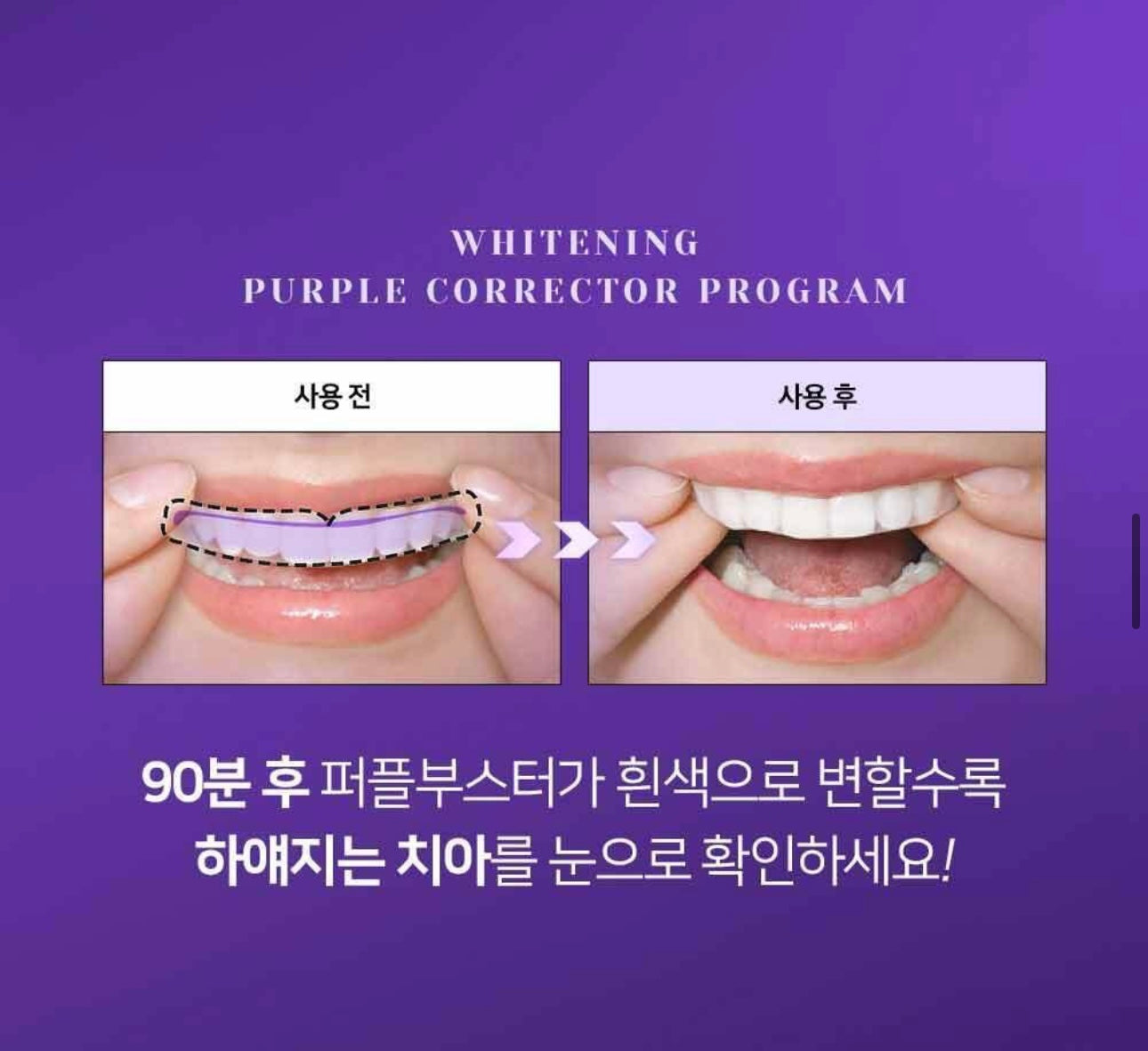 EUTHYMOL x Kuromi 牙齒亮白加強劑+牙齒亮白貼片🦷