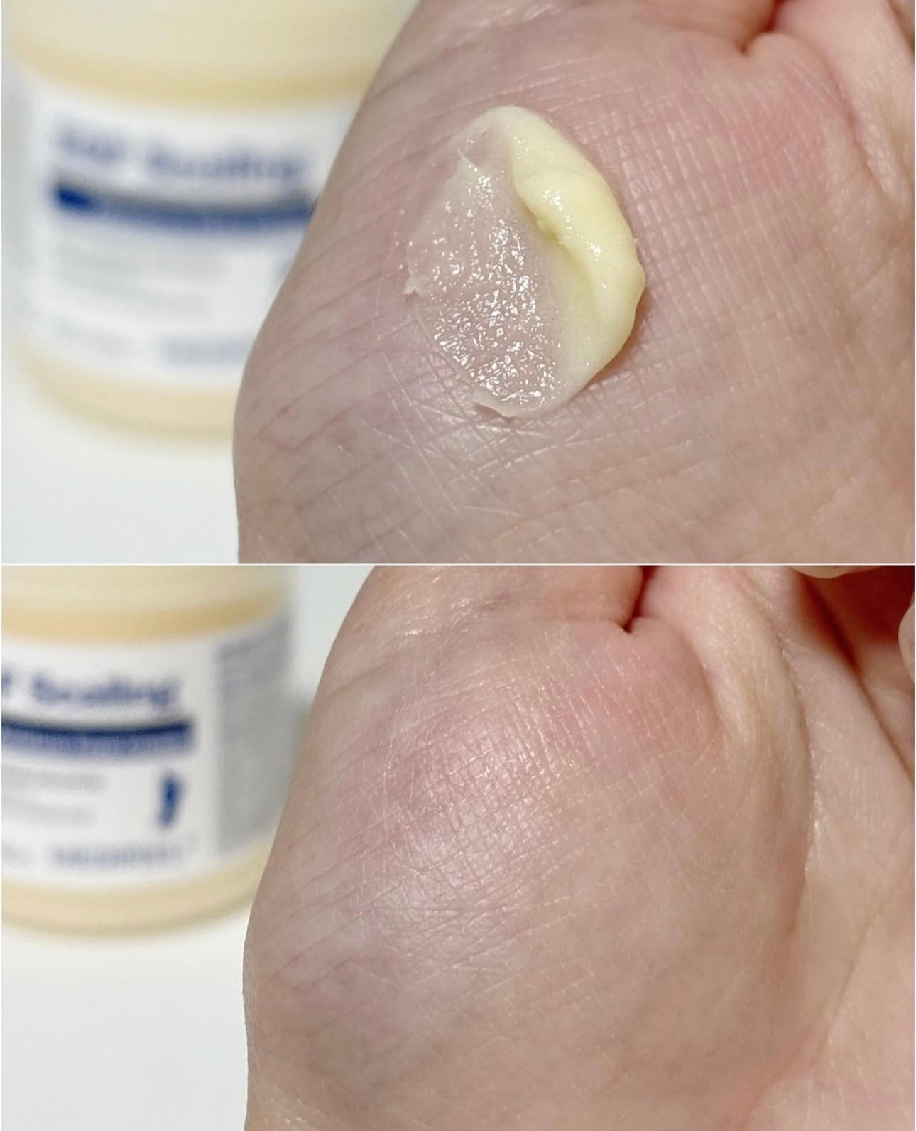 腳跟經常龜裂的必須入手🔥 MEDIPEEL EGF去角質深層滋潤修護足霜💖