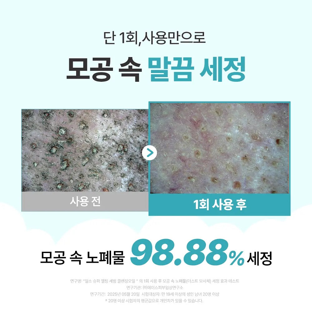 多送30ml✨ilso 天然溫和溶黑頭清毛孔卸妝油套裝Ilso natural mild cleansing oil set🪄