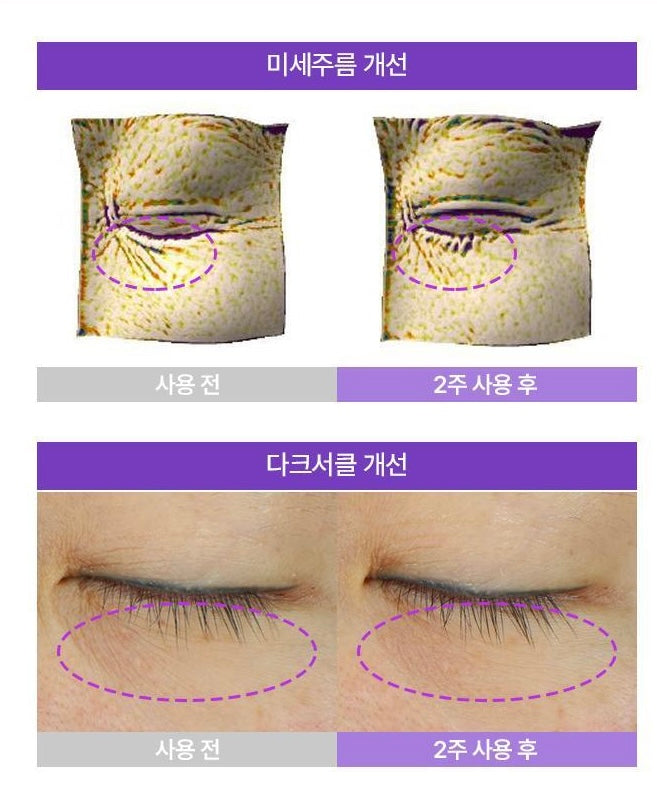 修復舒緩雙重加持💫BOH PROBIODERM 3D立體緊緻益生菌眼霜💜| BOH PROBIODERM 3D Lifting Eye & Wrinkle Cream