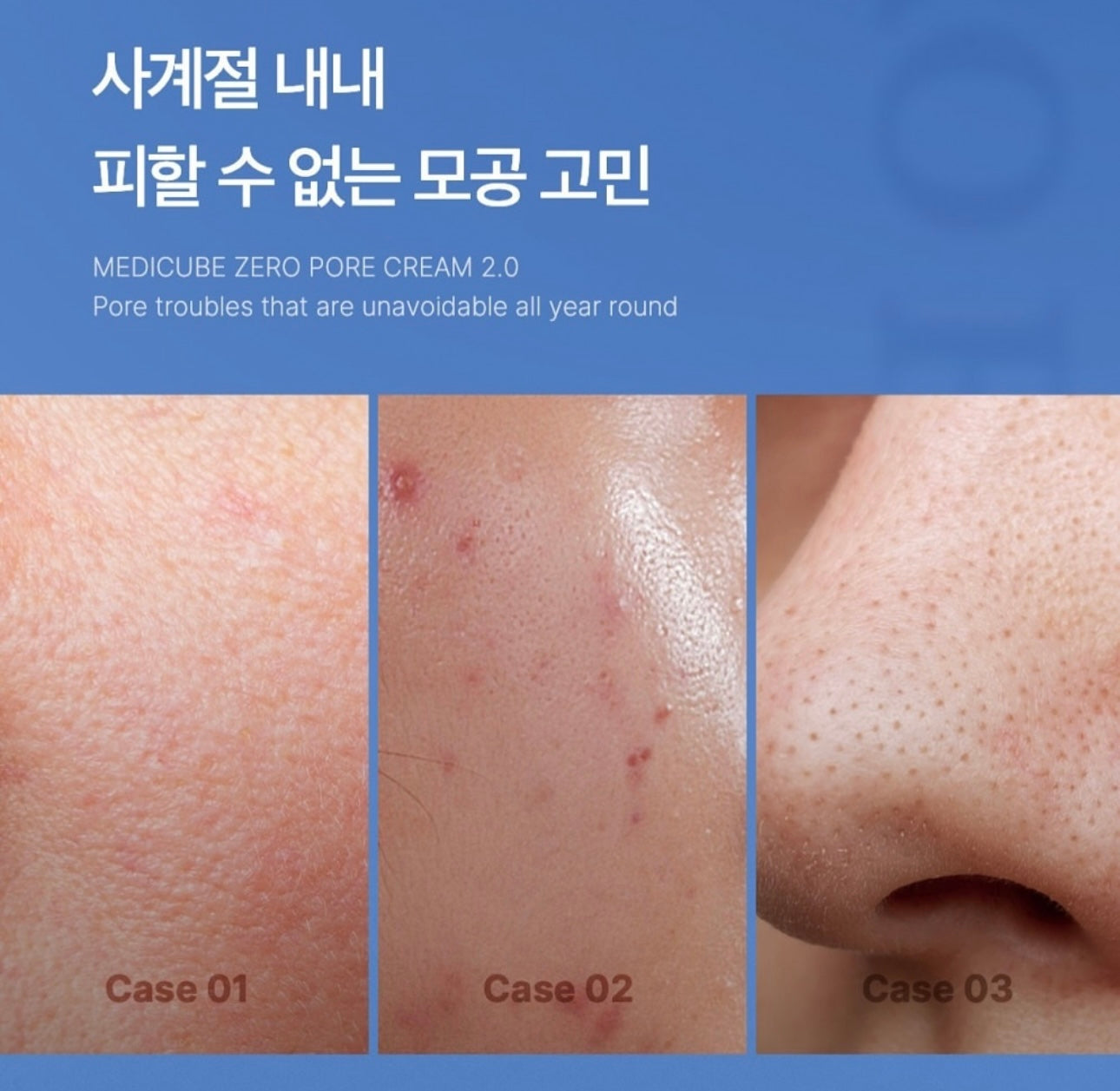 2個星期看到毛孔緊致效果✨| Medicube 緊緻收縮毛孔面霜 | Medicube Zero Pore Cream 2.0| 通過韓國皮膚科學研究院認證🏥