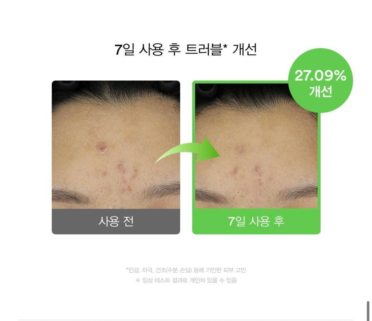 送土豆熊行李牌✨Abib 魚腥草積雪草舒緩膠囊精華液 🌿 Abib Heartleaf TECA Capsule Serum 敏感肌的安心選擇🧏🏻‍♀️