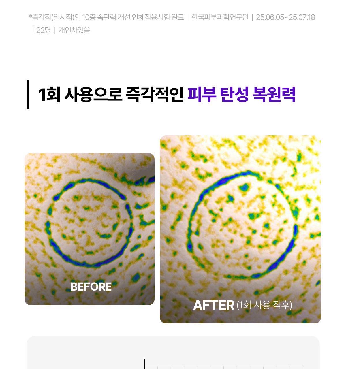 院線級修復🏥Centellian 24 PDRN 專家版高濃縮肌膚修復再生面霜✨ 醫美術後、敏感肌救星⭐️