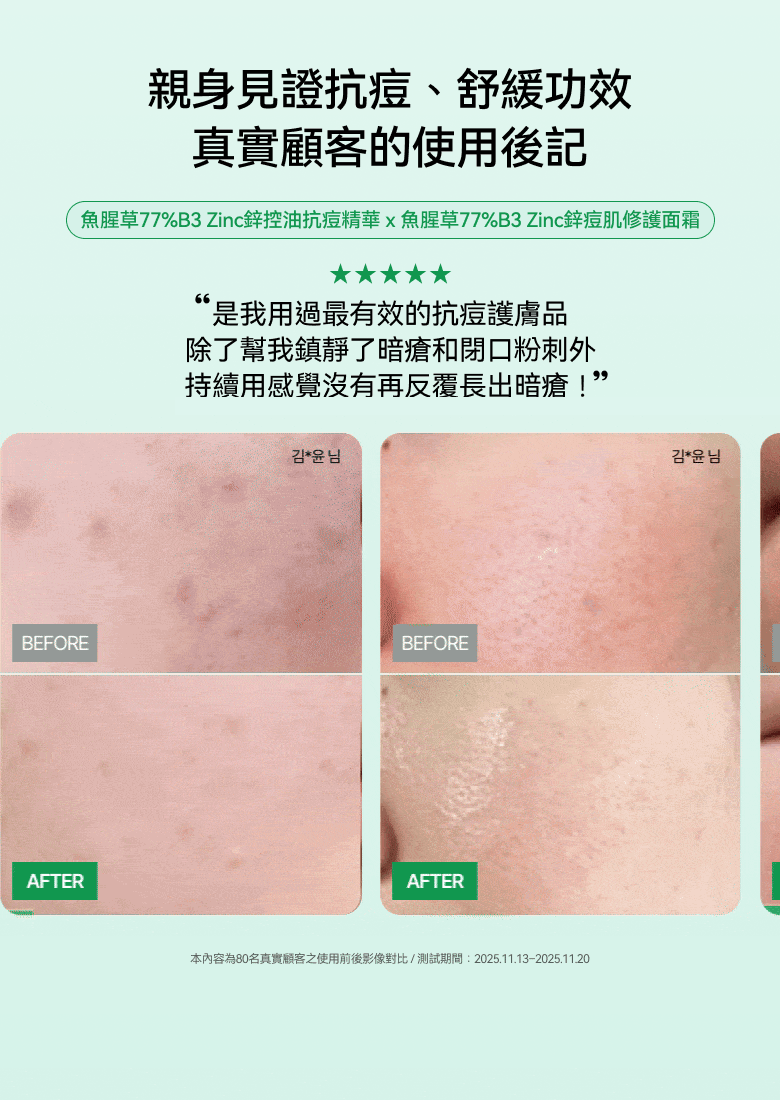 限時優惠$138🌟一抹閉口泛紅全退散 ✨韓國純淨保養品牌🌿 Anua 77% 魚腥草B3鋅舒緩修護霜ANUA HEARTLEAF 77 R3ZINC SOOTHING CREAM