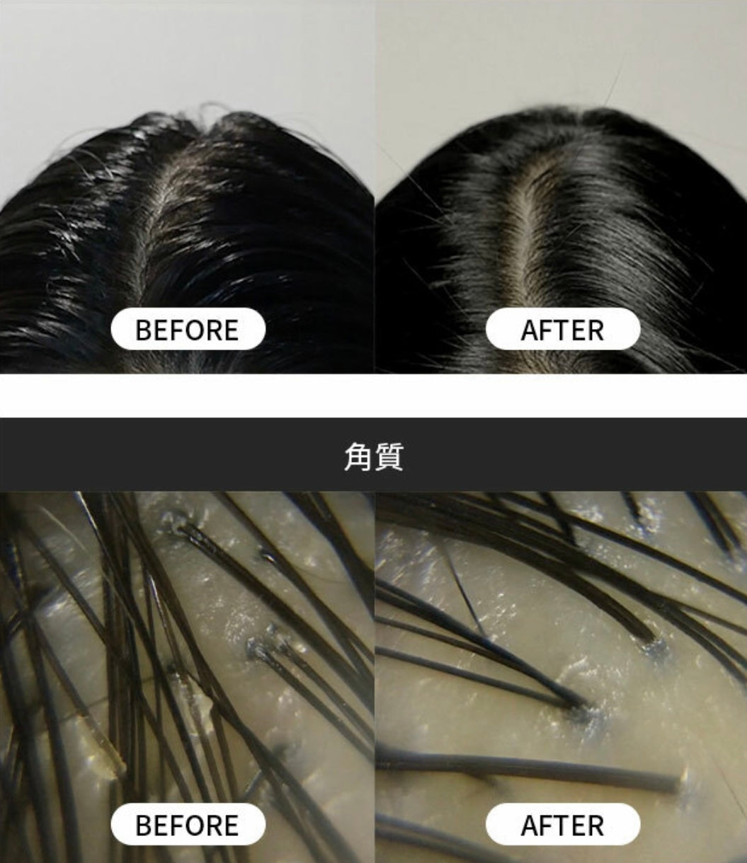 海水浴療法💆🏼‍♀️| GROWUS Sea Salt Therapy Scalp Scaler 海鹽去角質磨砂膏💫 韓國銷量冠軍產品 No.1🥂