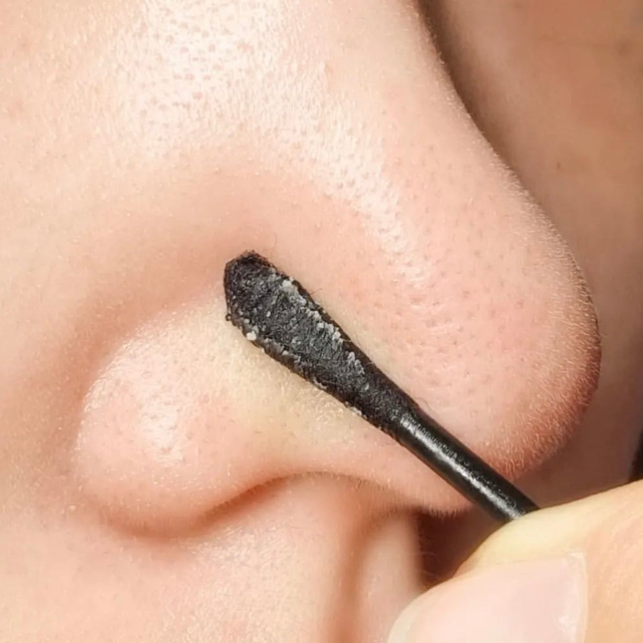全新升級版🔥 送40 片專用導出棉✨草莓鼻、大油田的終極救星！MediPeel 升級版 3X 毛孔融油精華導出液