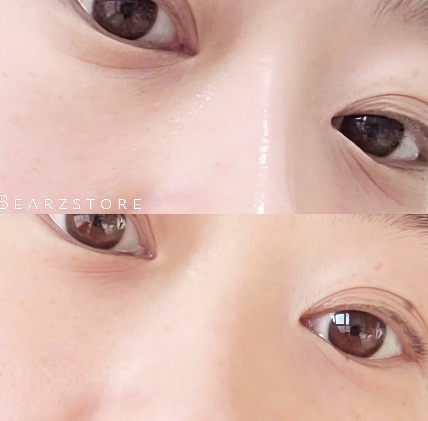 Dr.Melaxin 隱形眼袋修護霜👀| 一抹重塑眼下澎潤感 眼下凹陷救星✨