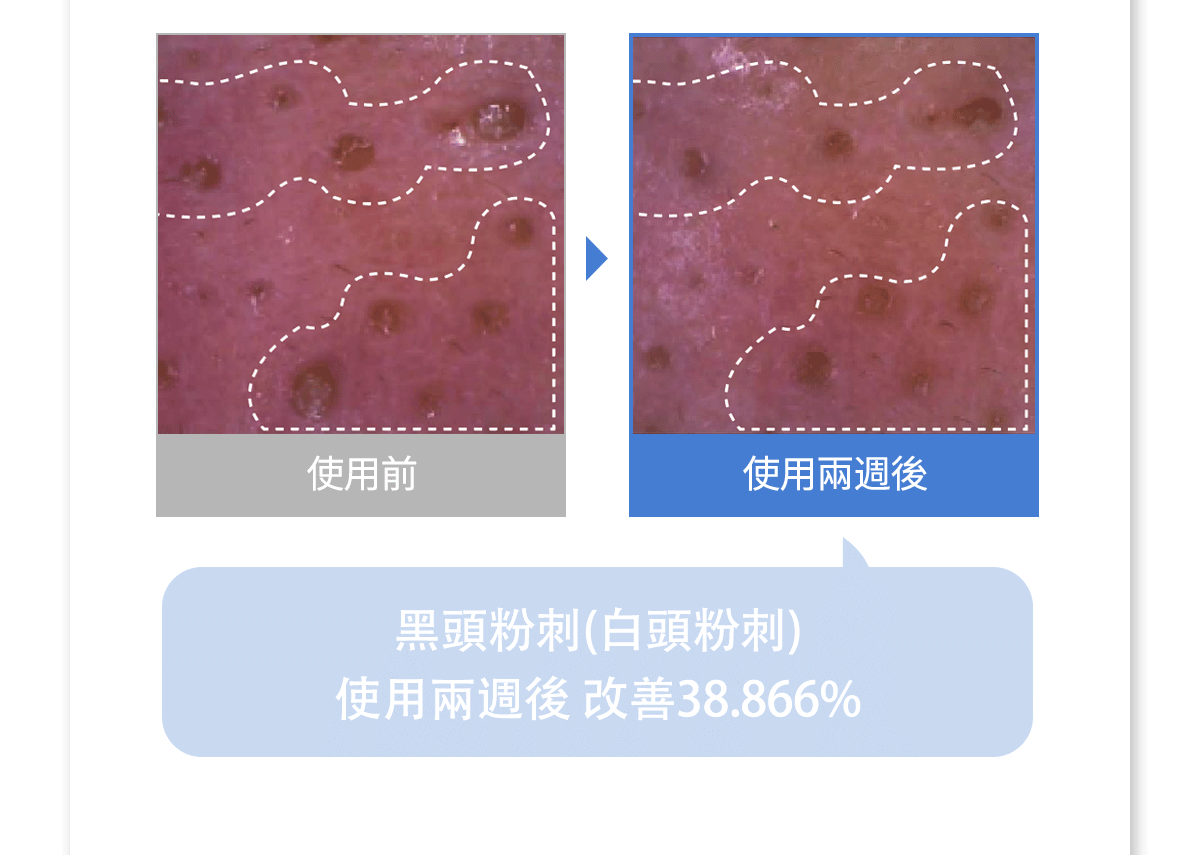 2個星期看到毛孔緊致效果✨| Medicube 緊緻收縮毛孔面霜 | Medicube Zero Pore Cream 2.0| 通過韓國皮膚科學研究院認證🏥