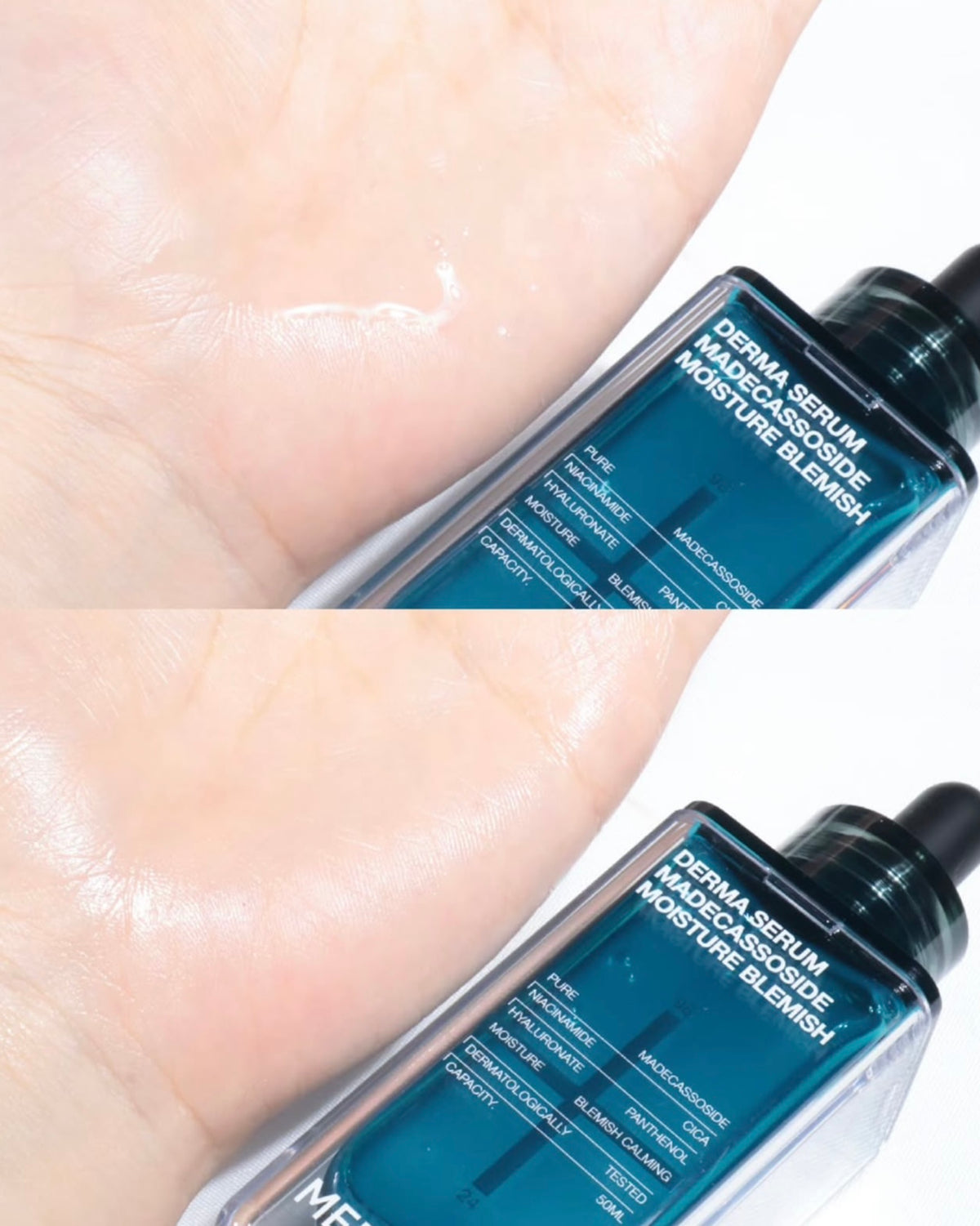 MEDIHEAL x 布丁狗🍮限量聯名✨升級版🔥強效淡印修復痕跡補水精華🩵 DERMA SERUM MADECASSOSIDE
MOISTURE BLEMISH
