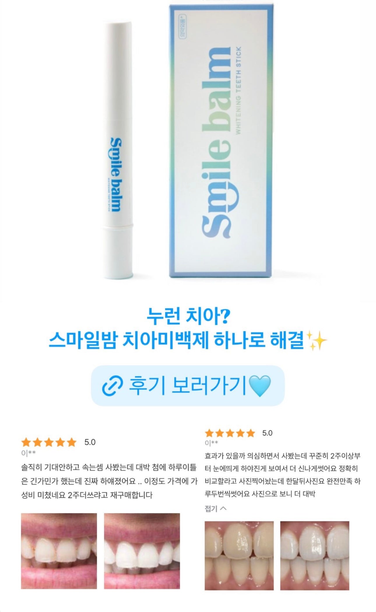 4周見效！Proval Smile Balm 牙齒美白拋光精華🤍🦷