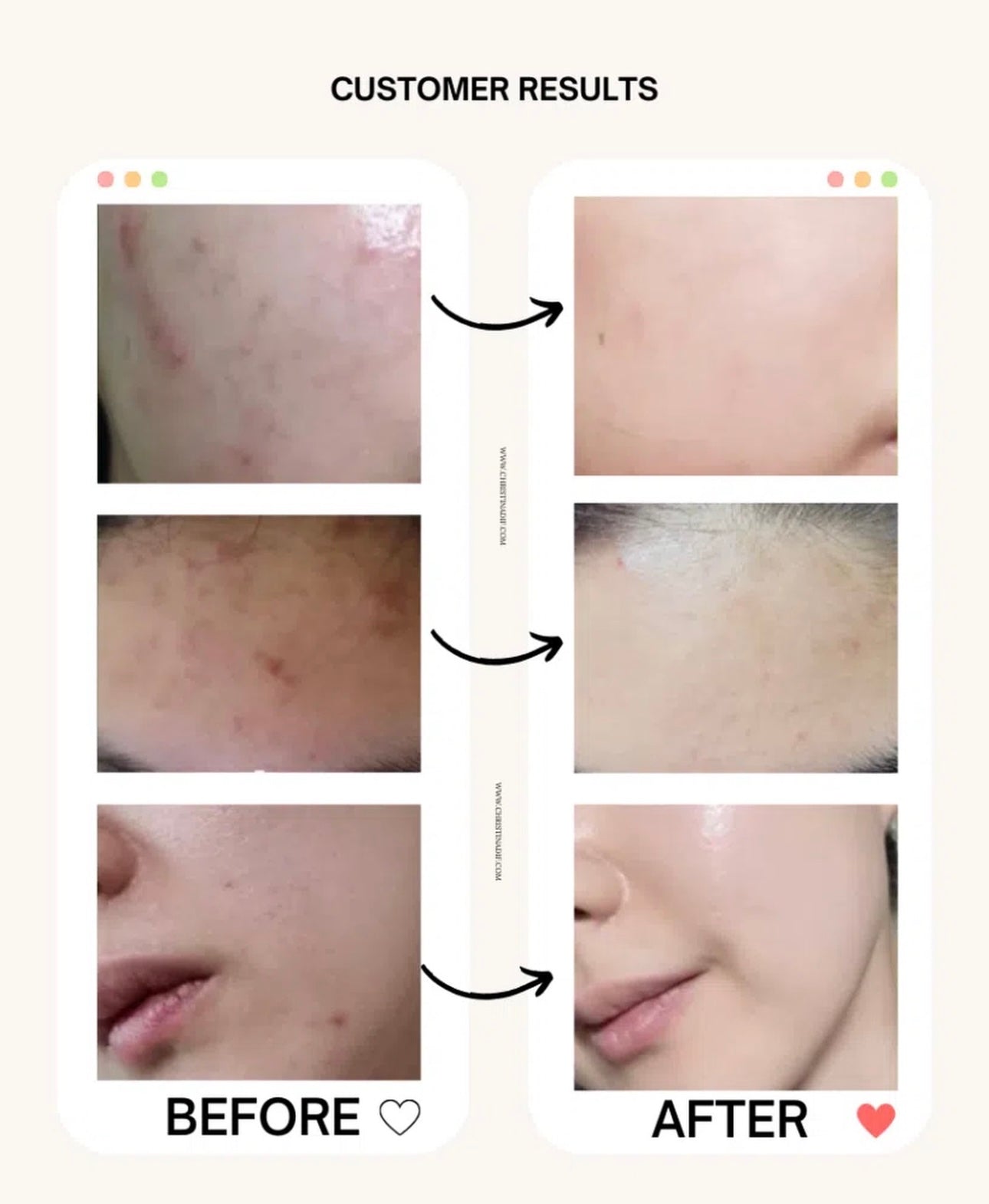 多送10ml✨ Beauty of Joseon 朝鮮美人蜂膠煙酰胺抗炎美白保濕精華🐝 Glow Serum「毛孔管理 + 光澤修護」精華💫