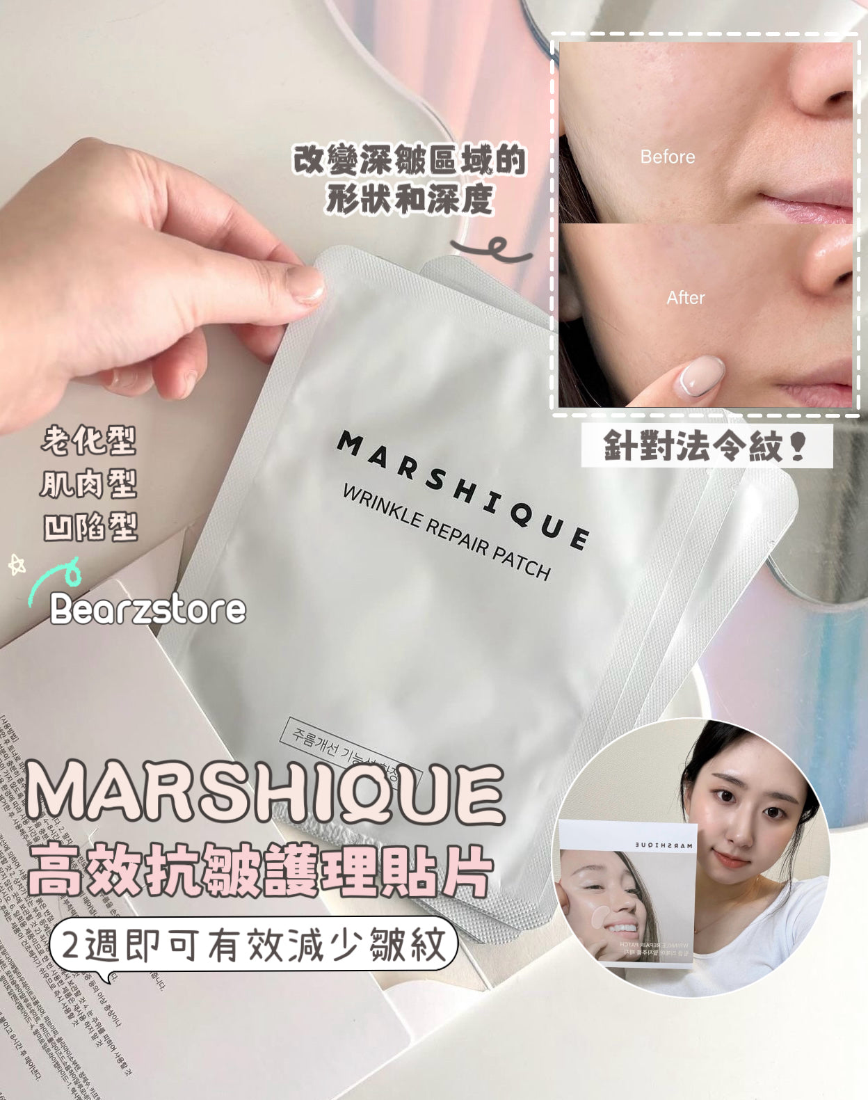 最近韓國熱賣❤️‍🔥MARSHIQUE 高效抗皺護理貼片| MARSHIQUE Wrinkle Repair Patch | 針對法令紋✨