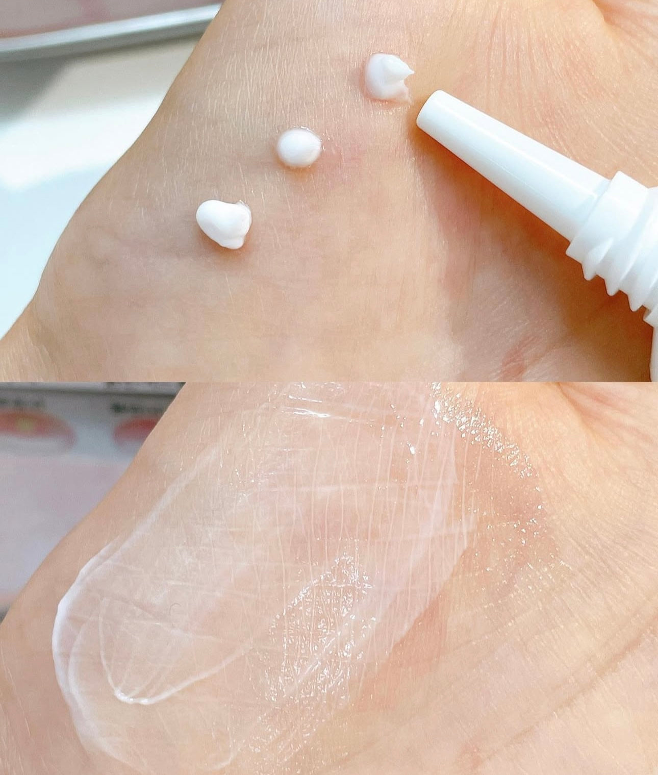 韓國藥房熱銷No.1🥇|韓國東亞製藥Dongah Acnon Cream抗炎殺菌袪痘膏☁️