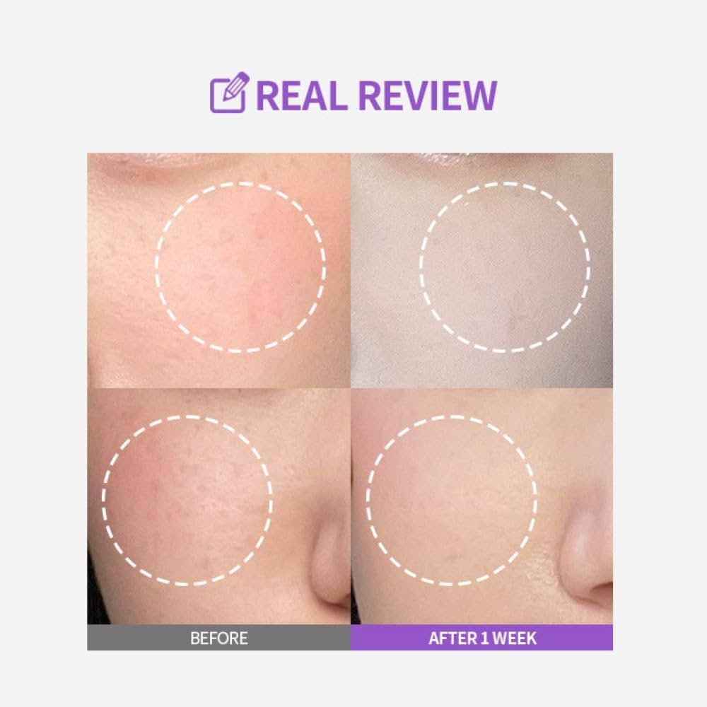 Sungboon Editor 山葡萄維他命C亮白棉片🪻 Sungboon Editor Meoru Podo VitaC Turn Over Dark Spot Pad💜