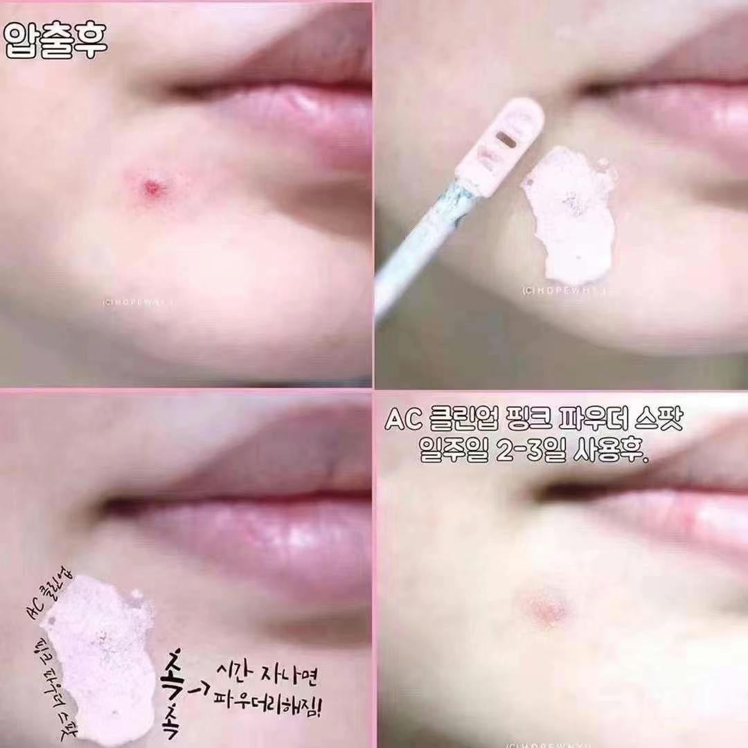 Etude House AC Clean Up Pink Powder Spot 痘痘消炎抗菌急救液